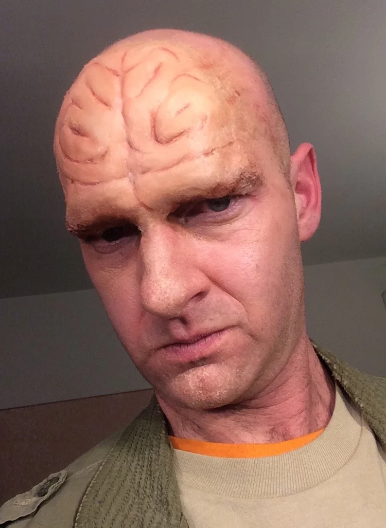 brain cranial appliance